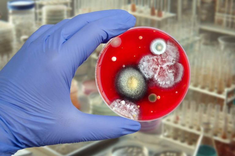 Bactérie et moisissures dans une culture en laboratoire - crédit photo : Kateryna Kon via Shutterstock